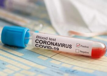 Ratusan Staf dan Santri Ponpes di Tasikmalaya Positif Covid-19