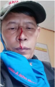 Soleman Wartawan FBI yang dipukulin oknum Ormas.