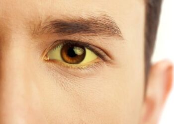 Kasus Hepatitis Misterius Meningkat