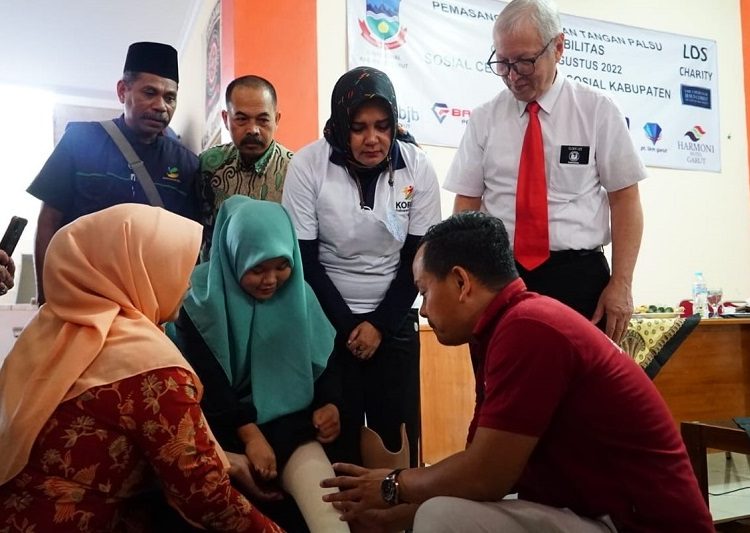 Pelaksanaan pemasangan kaki dan tangan palsu yang dilaksanakan di Aula Dinsos Garut, Jalan Patriot, Kecamatan Tarogong Kidul, Kabupaten Garut, Jum'at (5/8/2022).